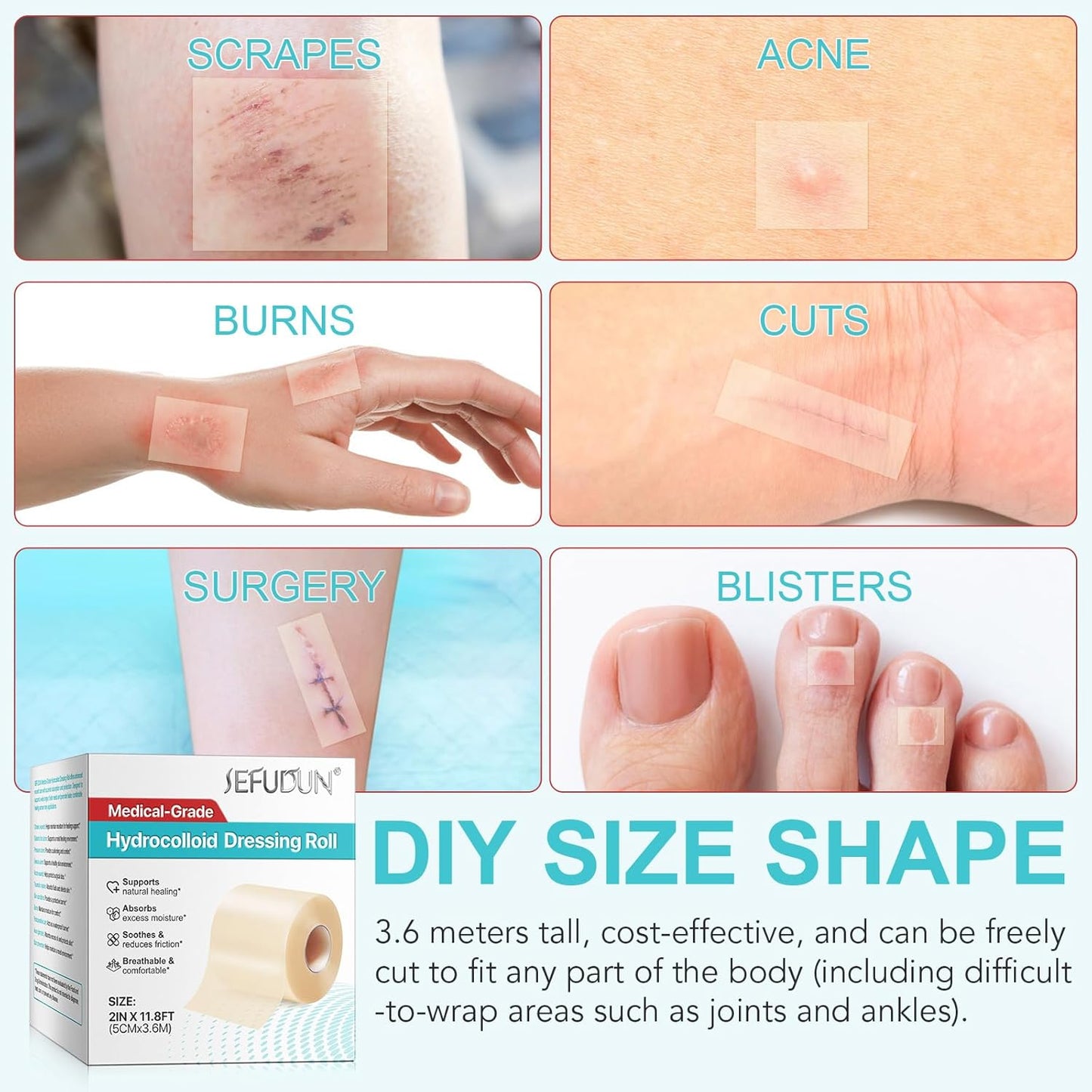 DERMTAPE Hydrocolloid Roll For Acne & Scarring